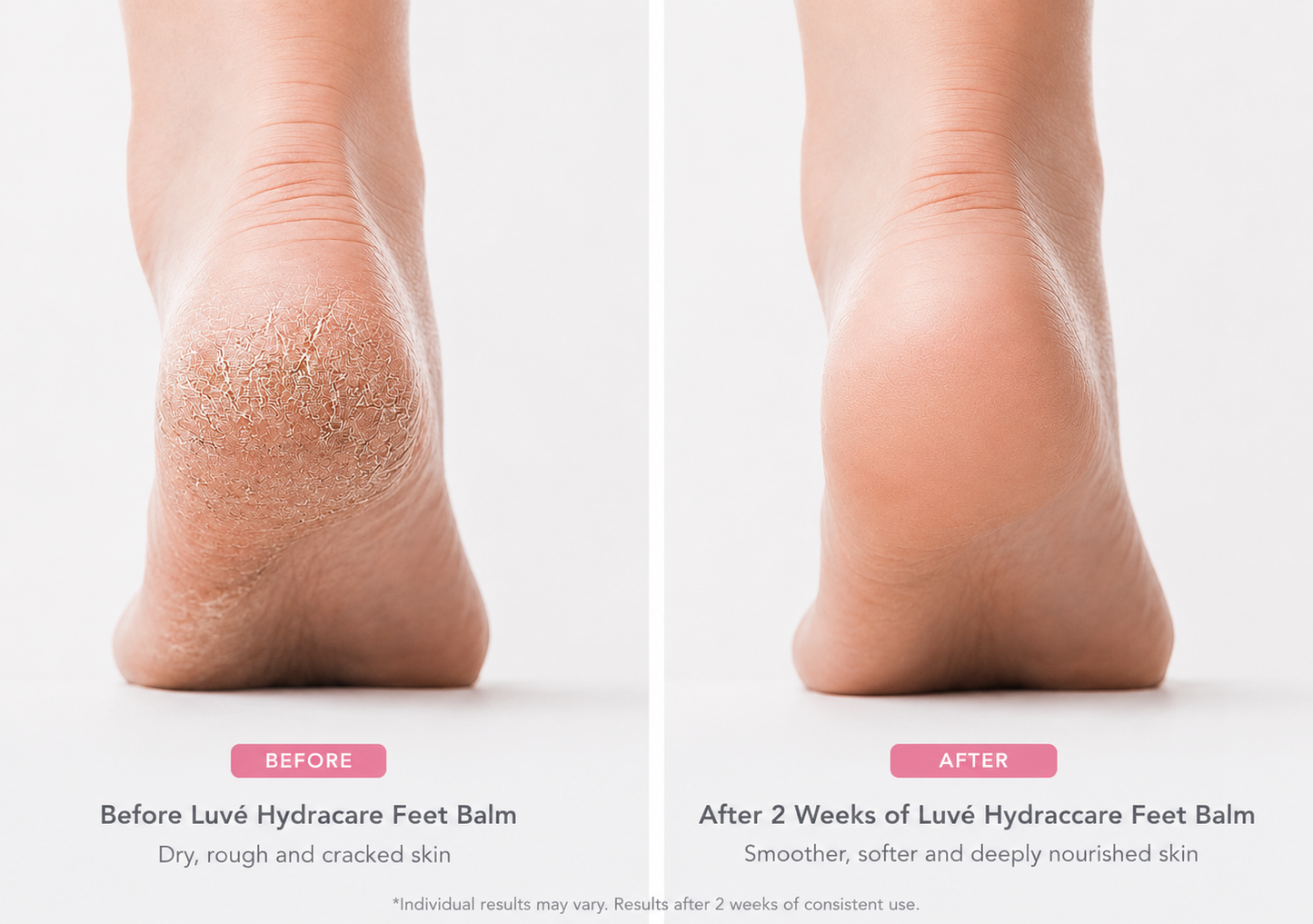 Luvé Hydracare Balm (Duo)