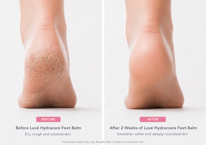 Luvé Hydracare Balm (Duo)